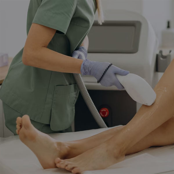 لیزر کار موهای زائد