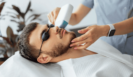 لیزر موهای زائد