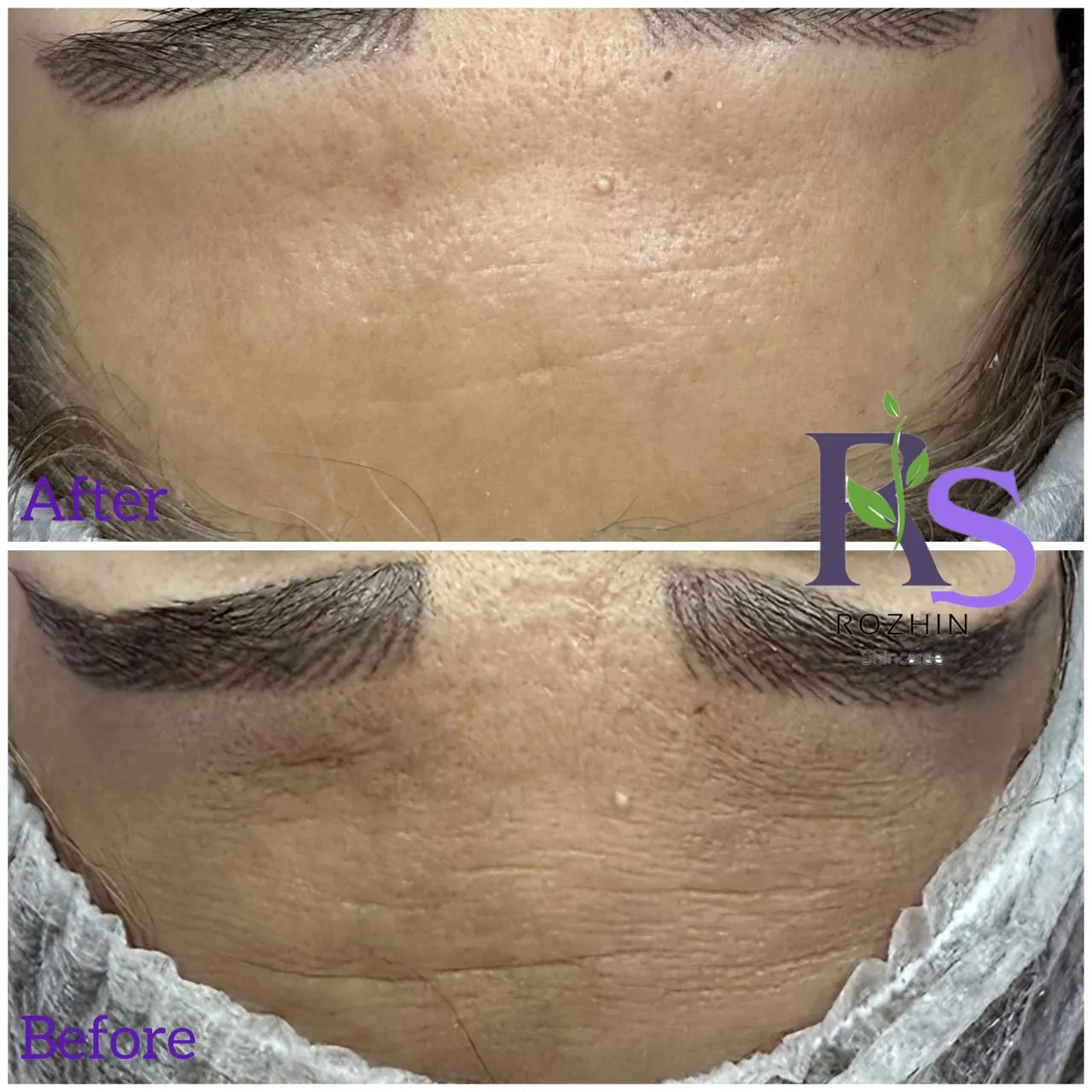 پکسازی و رفع چین و چروک