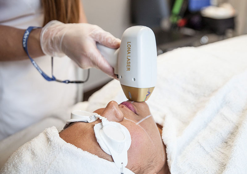 لیزر موهای زائد ۱۴۰۴: هزینه، ماندگاری، مزایا و معرفی بهترین کلینیک‌ها