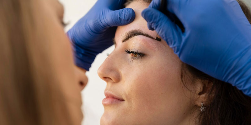کاشت ابرو